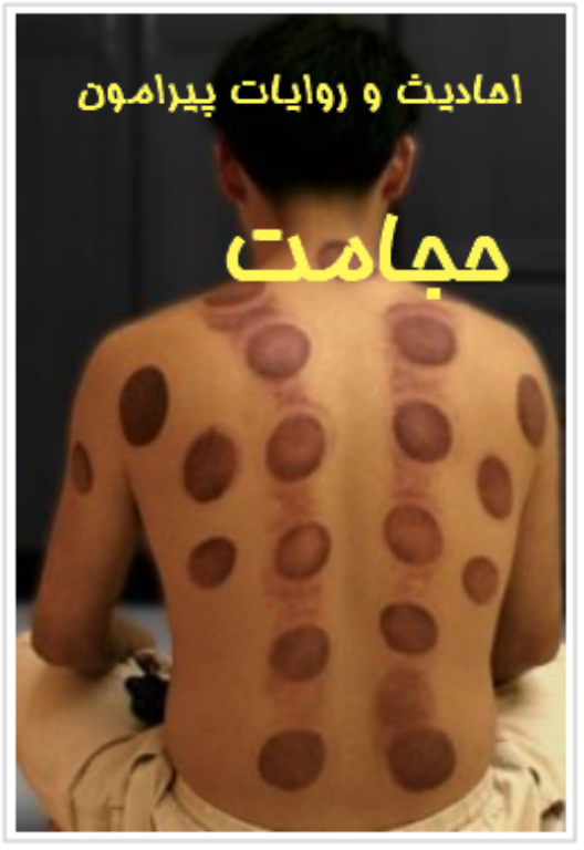 کتاب احادیث و روایات پیرامون حجامت