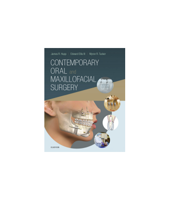 کتاب Contemporary Oral and Maxillofacial Surgery 1